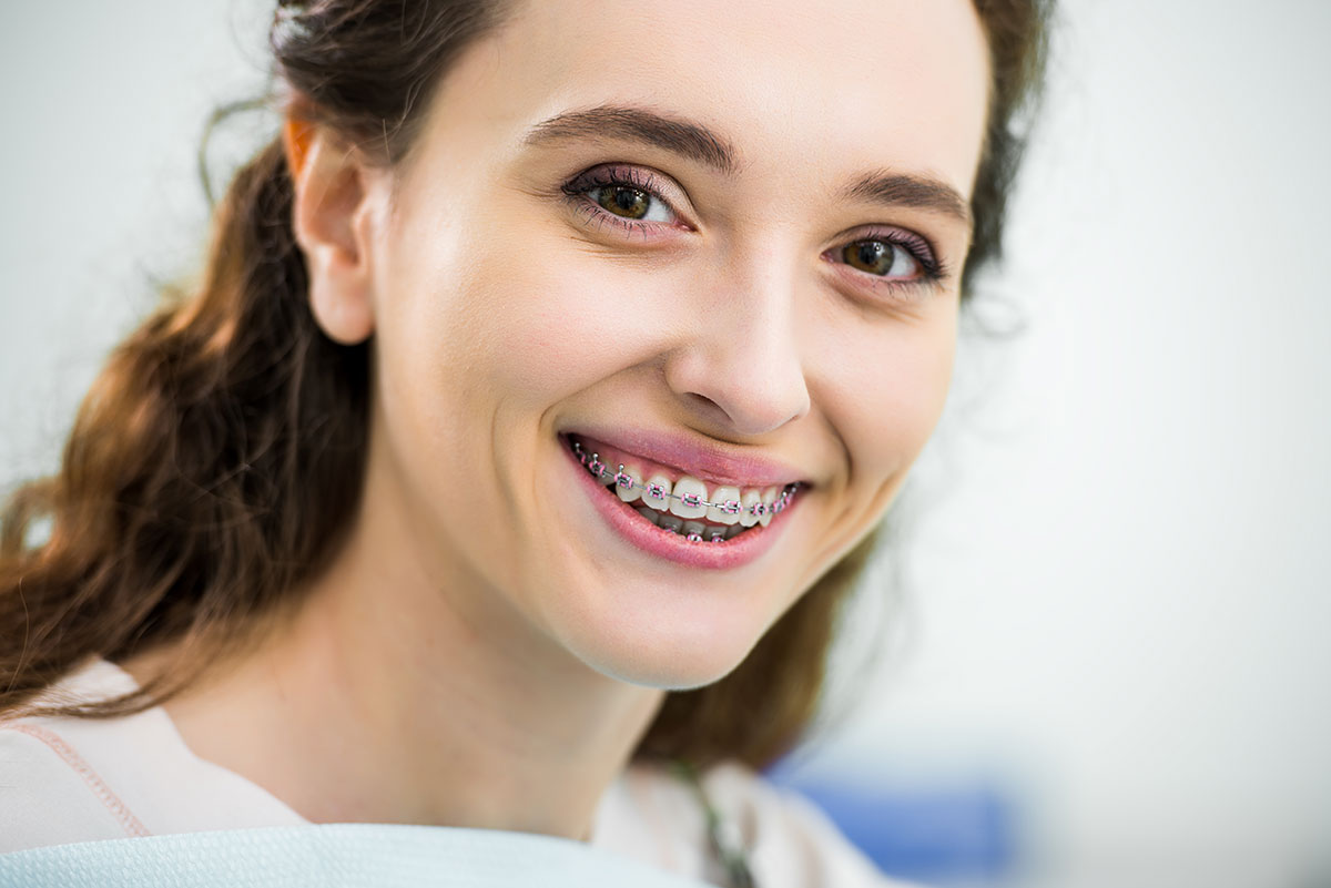 adult-braces