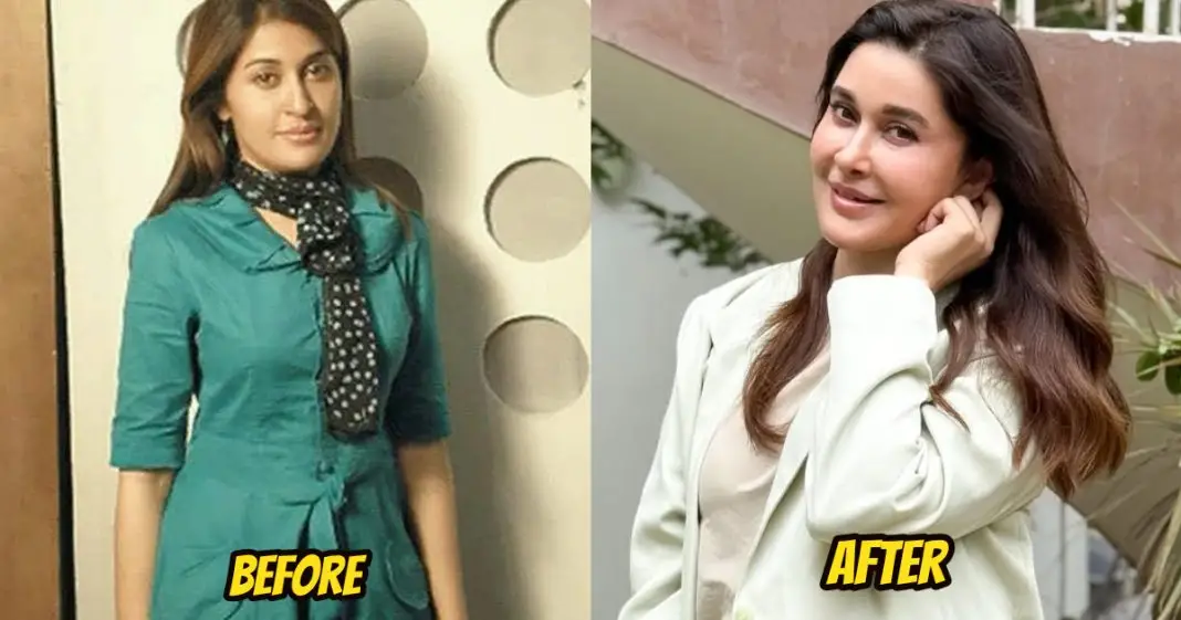 Shaista Lodhi Nose Job
